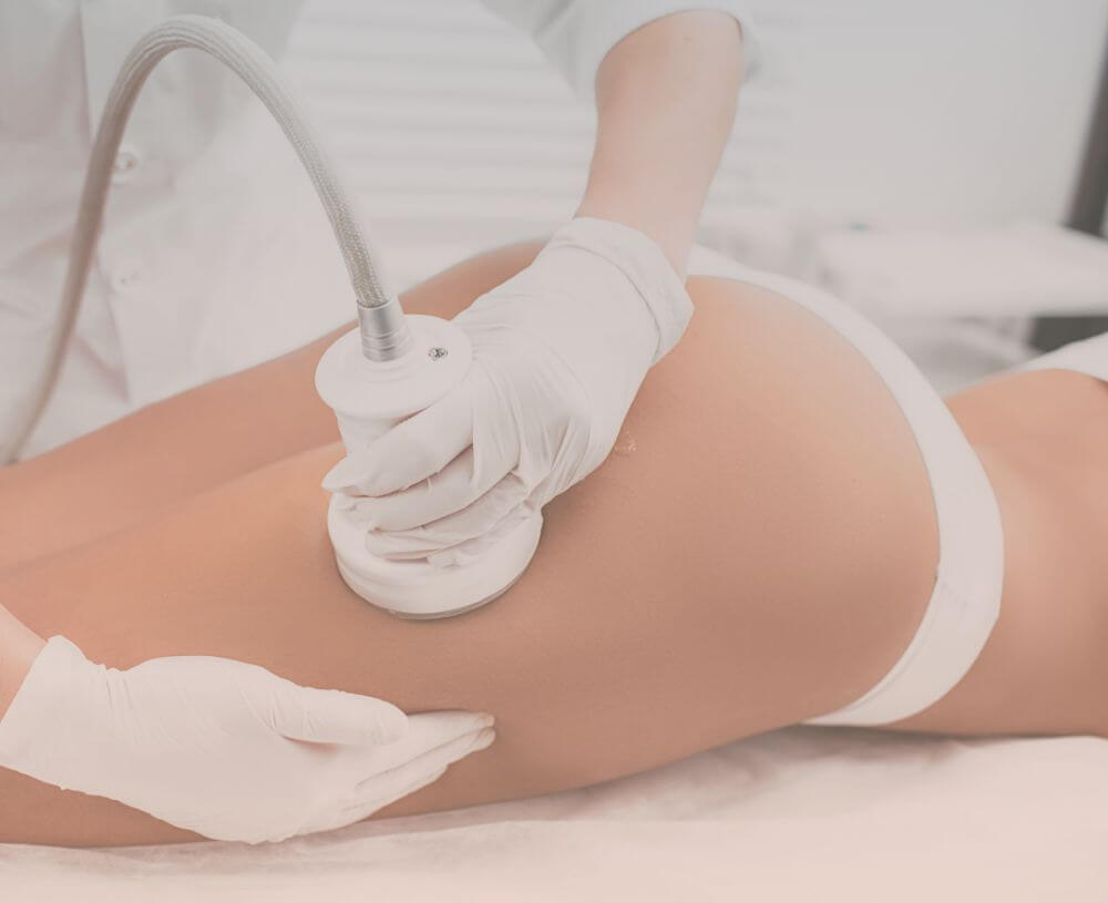 Soins médico-esthétique appliqués sur des cuisses