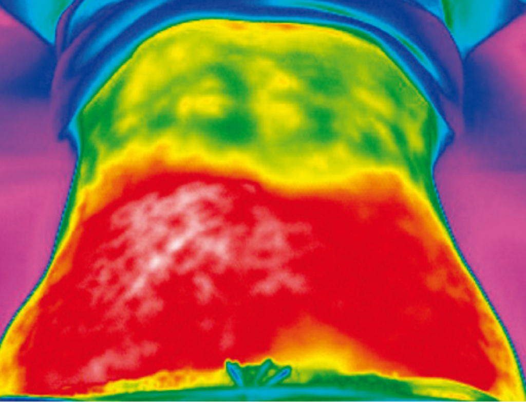 Une femme subissant le traitement VANQUISH ME qui brûle les graisses du ventre
